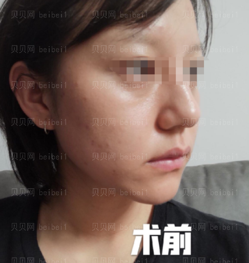 西京医院整形科樊星水光美肤介绍片较新分享_经过这次皮肤调节，我也有了更大的信心了哦。