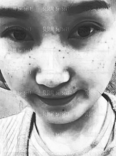 西京医院整形科樊星光子嫩肤介绍片较新分享_皮肤都变得白皙、嫩滑了哦！