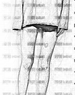 天津美莱医学美容医院王志军大腿吸脂介绍片较新分享_好身材就是这么简单！