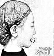 北京英煌医疗美容医院王良发医生鼻部手术记录分享，介绍实图查看